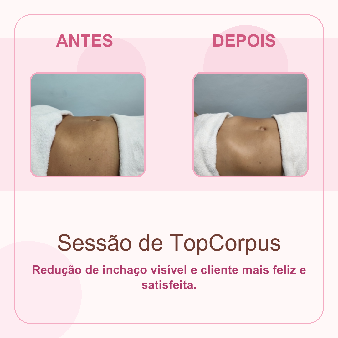 Antes e depois de sessão corporal mostrando redução de inchaço