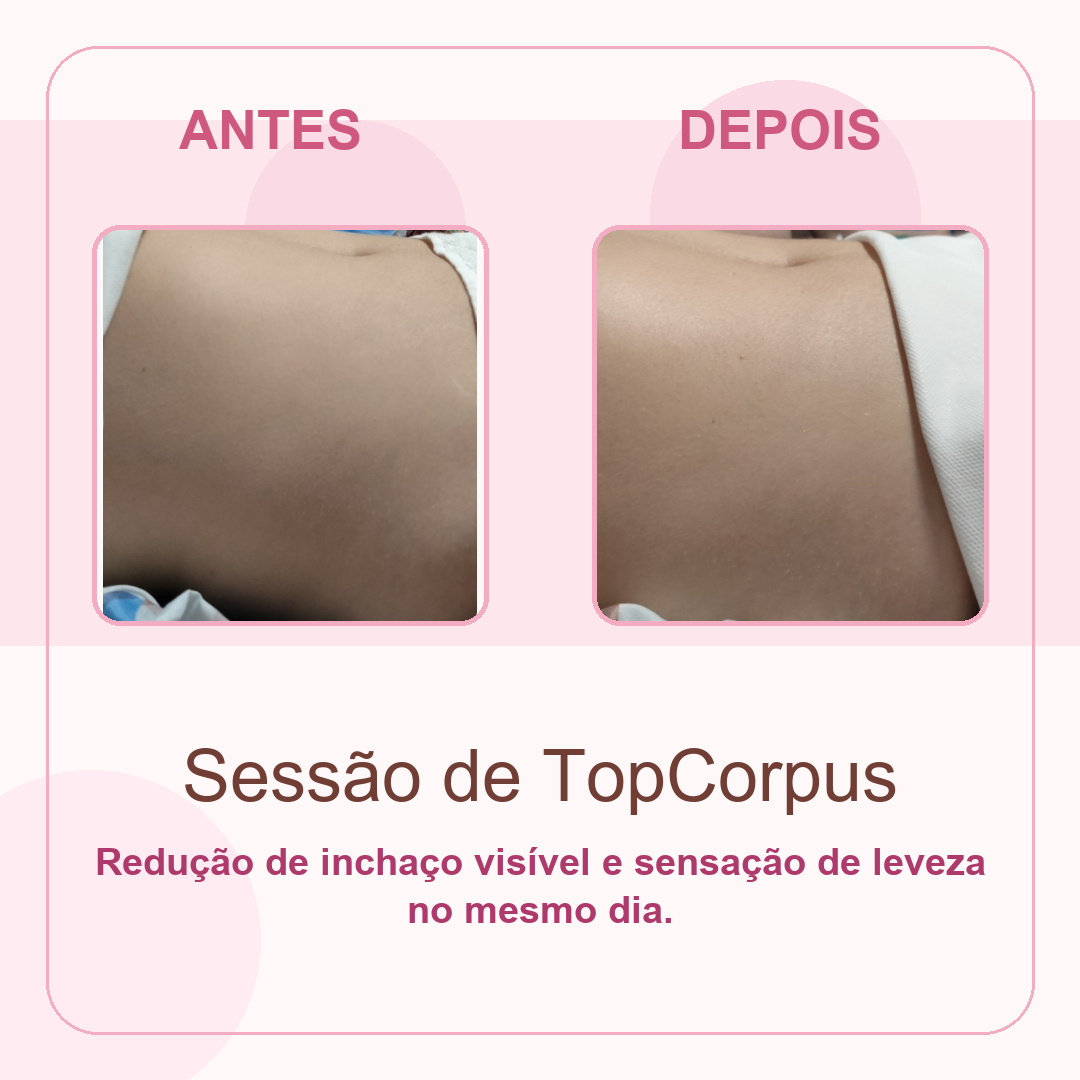 Antes e depois de sessão TopCorpus mostrando sensação de leveza